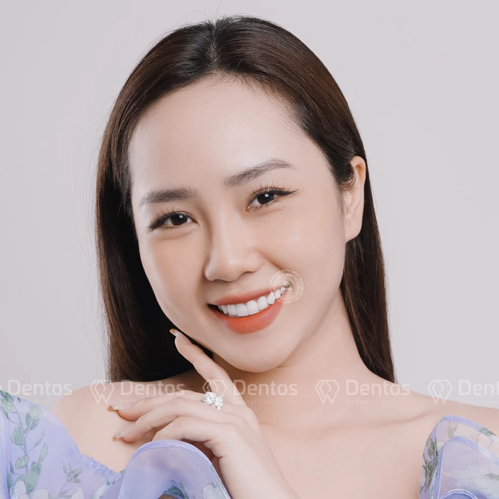 Răng sứ Lava Esthetic cho màu sắc tự nhiên và trung thực từ góc đến cạnh cắn